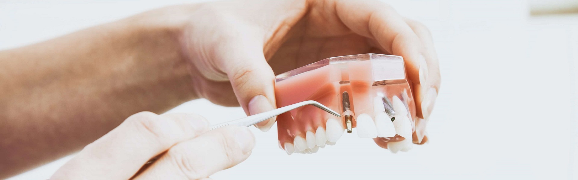 Sobna ulazna vrata brendovi | Zubni implanti Beograd